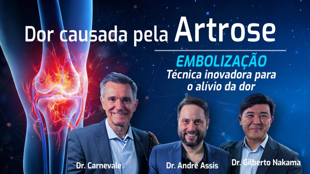embolização para artrose